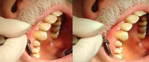 Gkr chez le dentiste